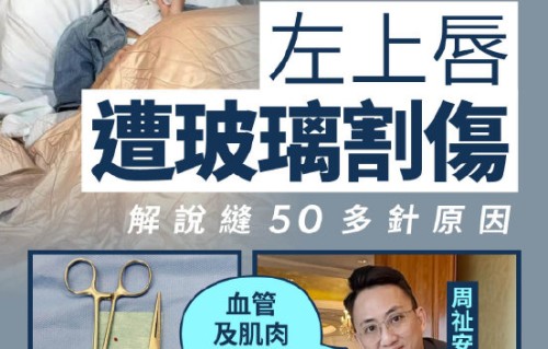 卫诗雅嘴唇受伤后目前恢复情况如何？