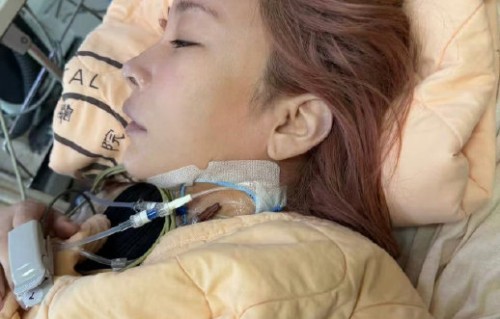 温岚大病后首次公开露面，身体恢复得怎么样了？|复出|气色|舞台|音乐会|洗肾