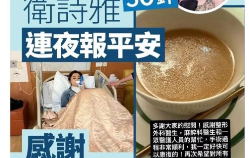 金像影后卫诗雅拍戏意外受伤严重！缝50多针，还不忘致歉报平安